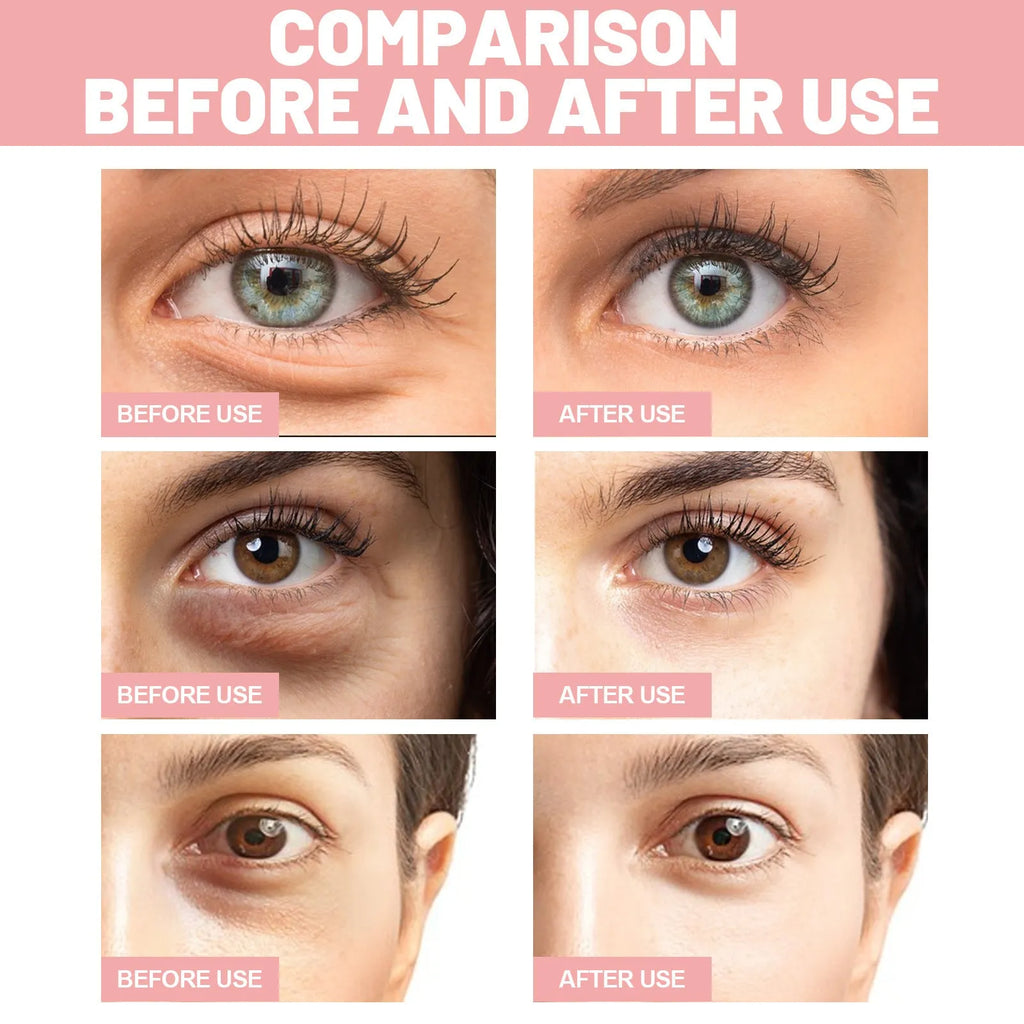 60 anti-wrinkle eye bag care patches with retinol and peptides for under-eye treatment