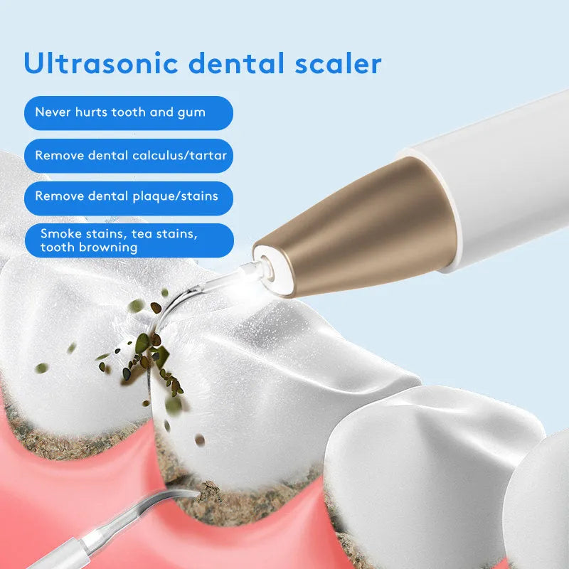 Gold ultrasonic tooth cleaner for removing tartar and stains with high-frequency vibration technology