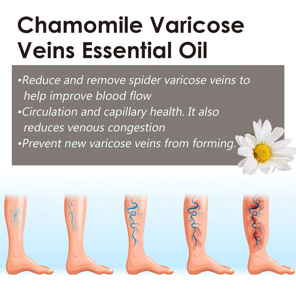 10ml bottle of chamomile leg essential oil for massage and discomfort relief