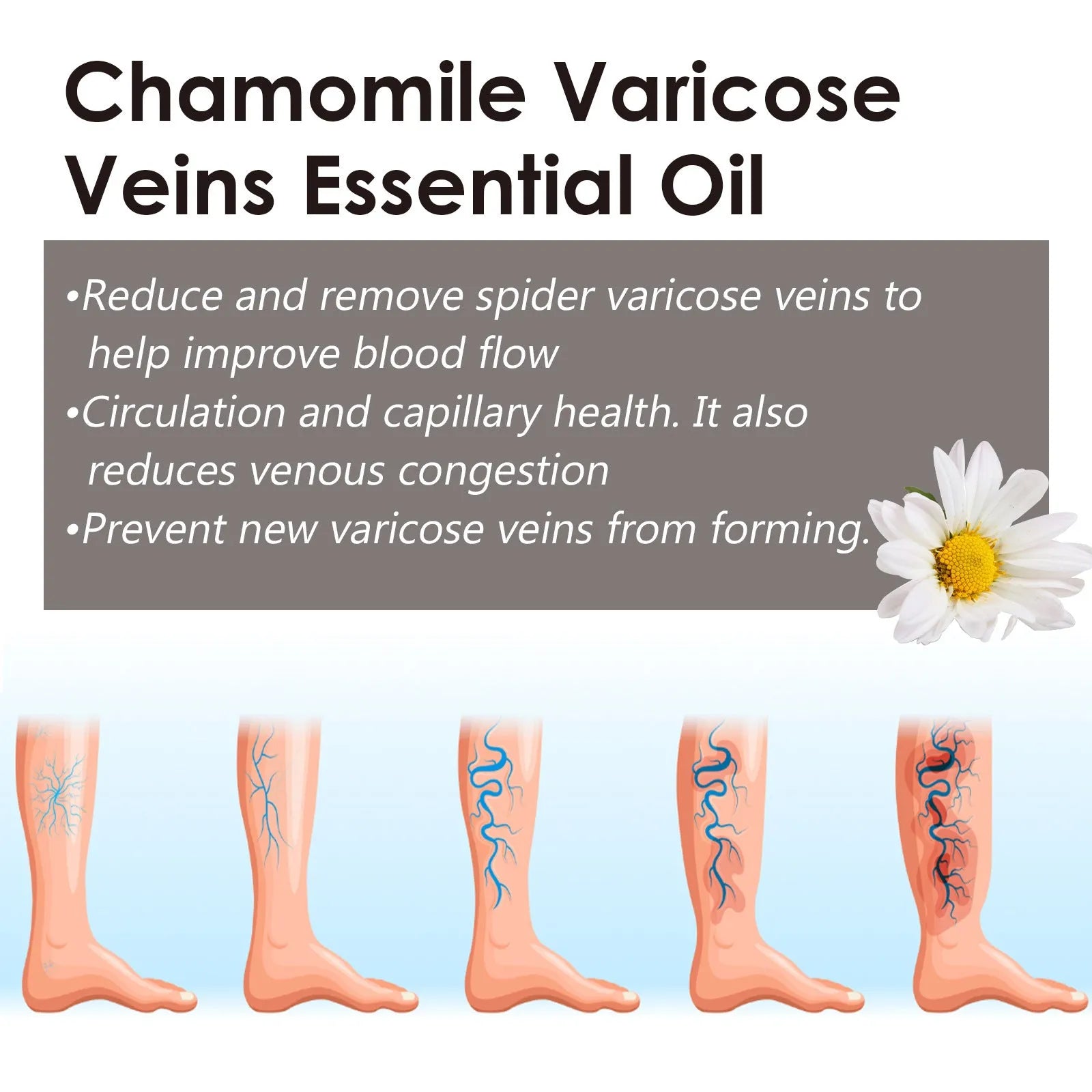 10ml bottle of chamomile leg essential oil for massage and discomfort relief