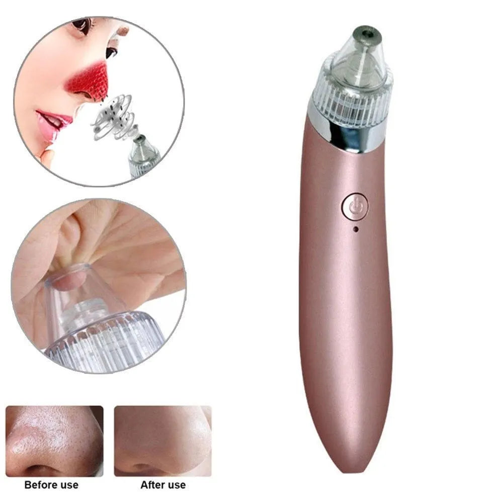 Beauty facial machine with 4 interchangeable heads for blackhead removal and pore cleansing, rose colour, rechargeable option
