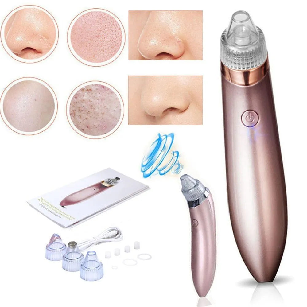 Beauty facial machine with 4 interchangeable heads for blackhead removal and pore cleansing, rose colour, rechargeable option