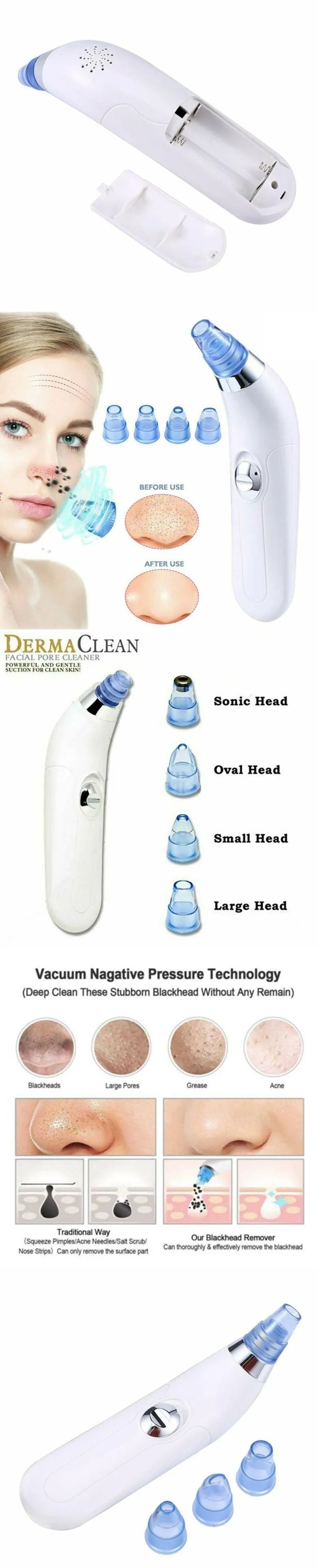 Electric blackhead pore cleaner in white and pink colours showing ultrasonic suction nozzle