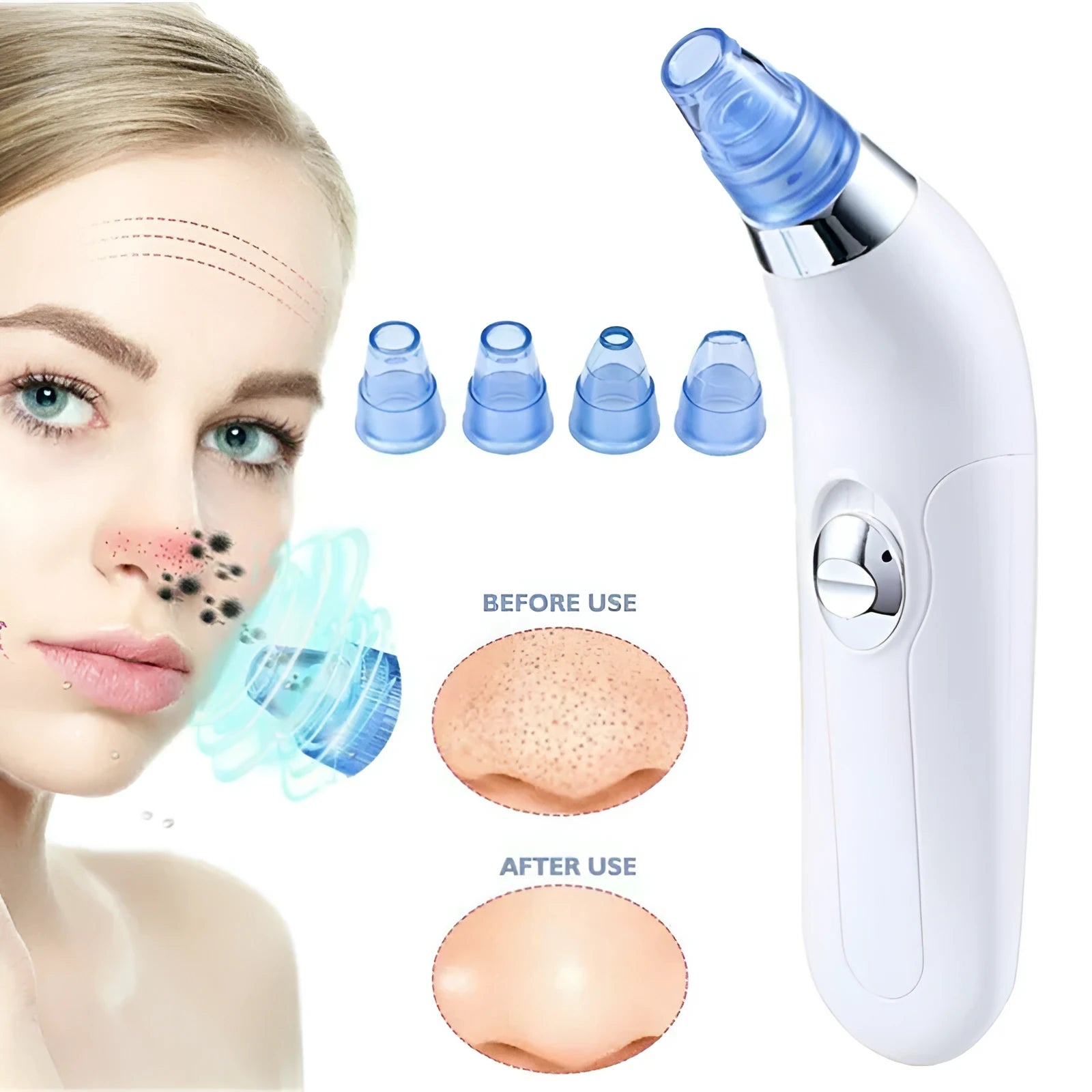 Electric blackhead pore cleaner in white and pink colours showing ultrasonic suction nozzle