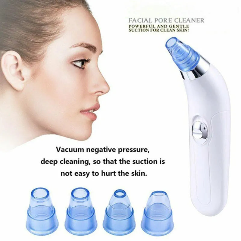 Electric blackhead pore cleaner in white and pink colours showing ultrasonic suction nozzle