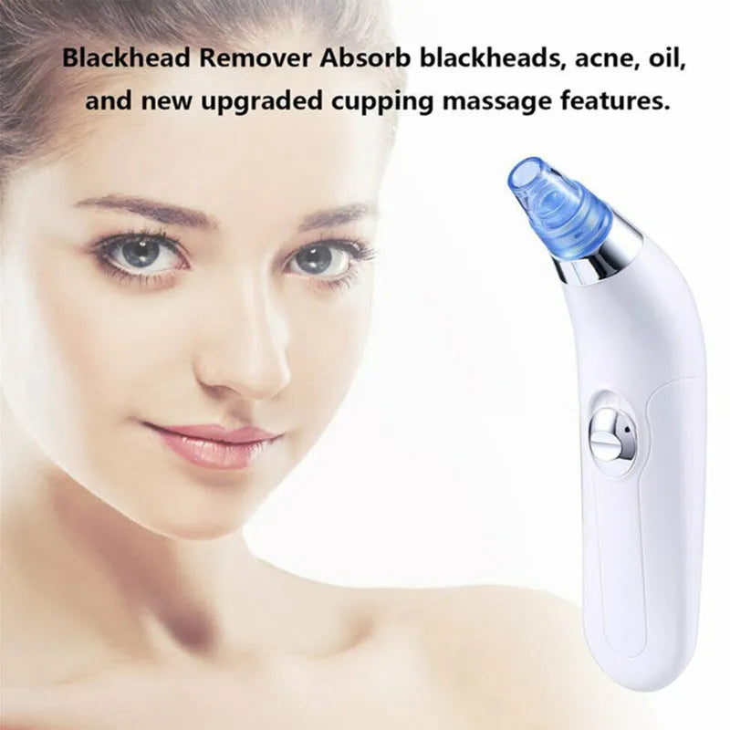 Electric blackhead pore cleaner in white and pink colours showing ultrasonic suction nozzle