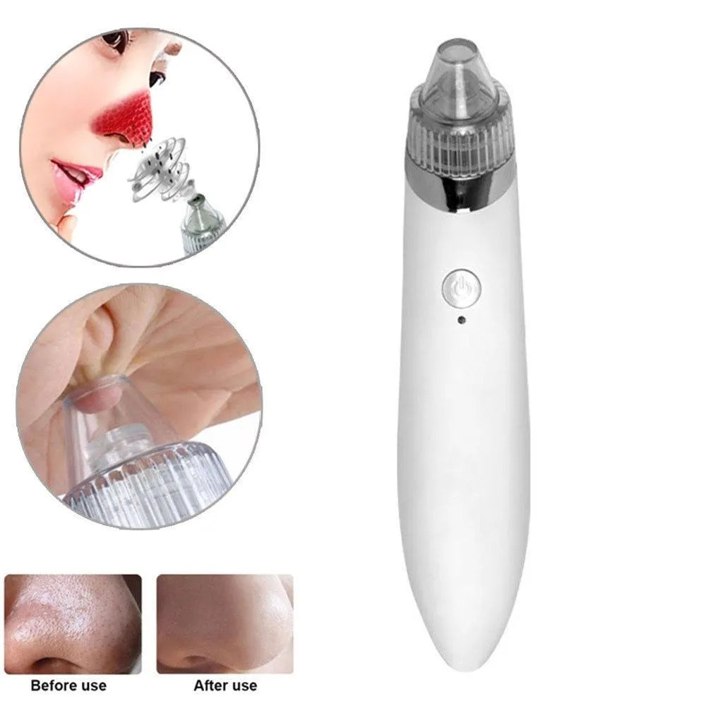 Beauty facial machine with 4 interchangeable heads for blackhead removal and pore cleansing, rose colour, rechargeable option