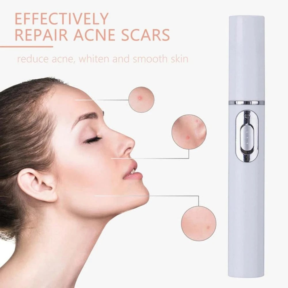 Blue Light Therapy Acne Laser Pen: Portable Scar & Wrinkle Removal Treatment Device for Flawless Skin Care Beauty Equipment