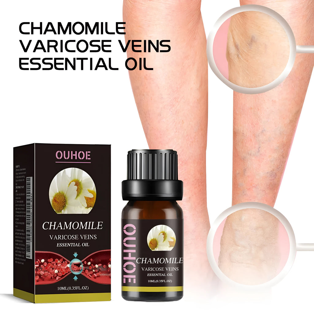 10ml bottle of chamomile leg essential oil for massage and discomfort relief