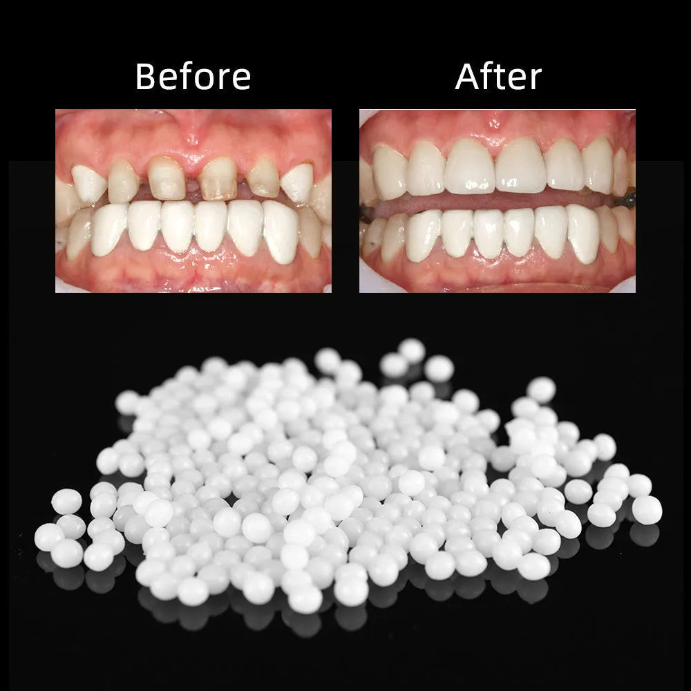 Bagged household teeth repair solid hot-soluble compound for temporary missing teeth gaps, 10g 20g 50g 100g options