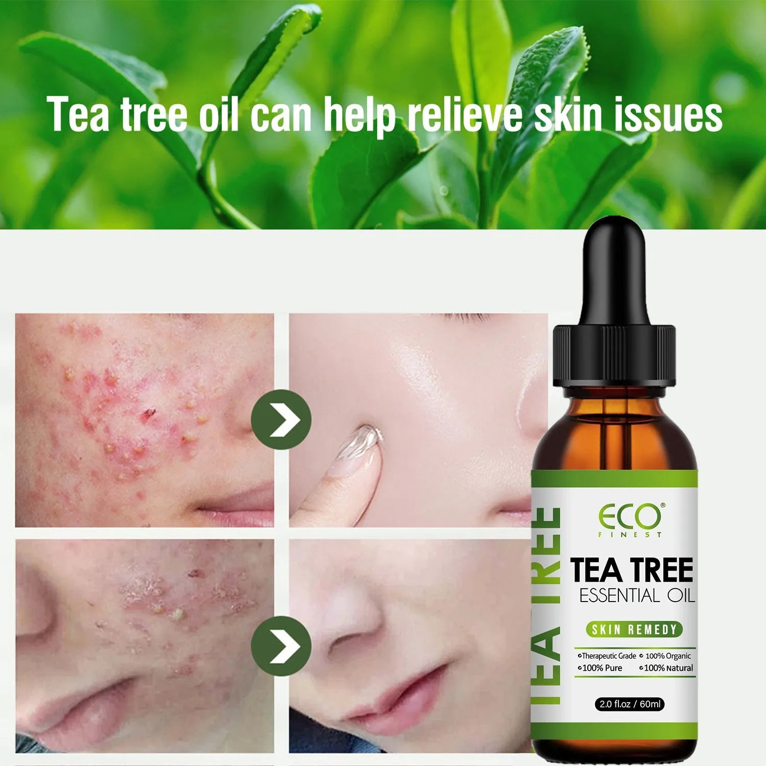60ml bottle of tea tree essential oil for acne treatment and massage applications