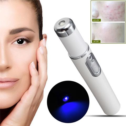 Blue Light Therapy Acne Laser Pen: Portable Scar & Wrinkle Removal Treatment Device for Flawless Skin Care Beauty Equipment