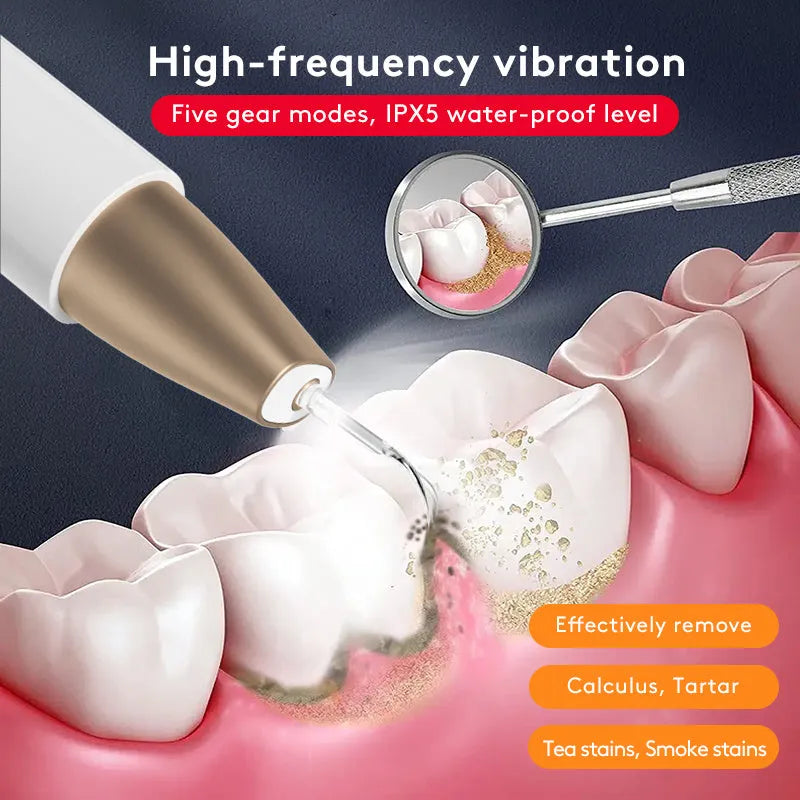 Gold ultrasonic tooth cleaner for removing tartar and stains with high-frequency vibration technology