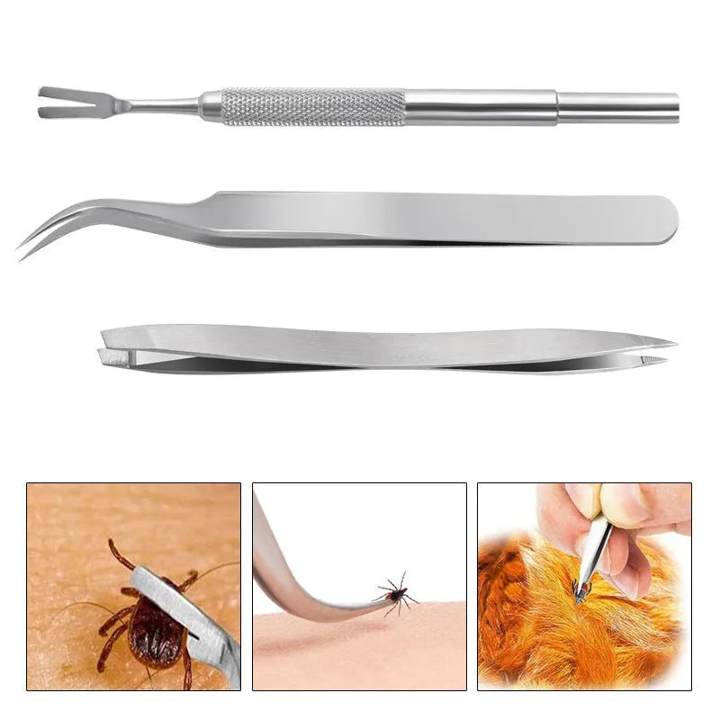 Silver stainless steel tick clip 3-piece set for dog and cat parasite removal