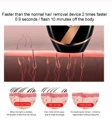 Black ABS IPL laser hair removal machine with 350,000 flashes for full body use, compact 14x7.5x4.5 cm
