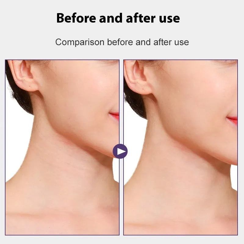 V27 neck pattern firming tape with skin-coloured adhesive straps and replacement patches