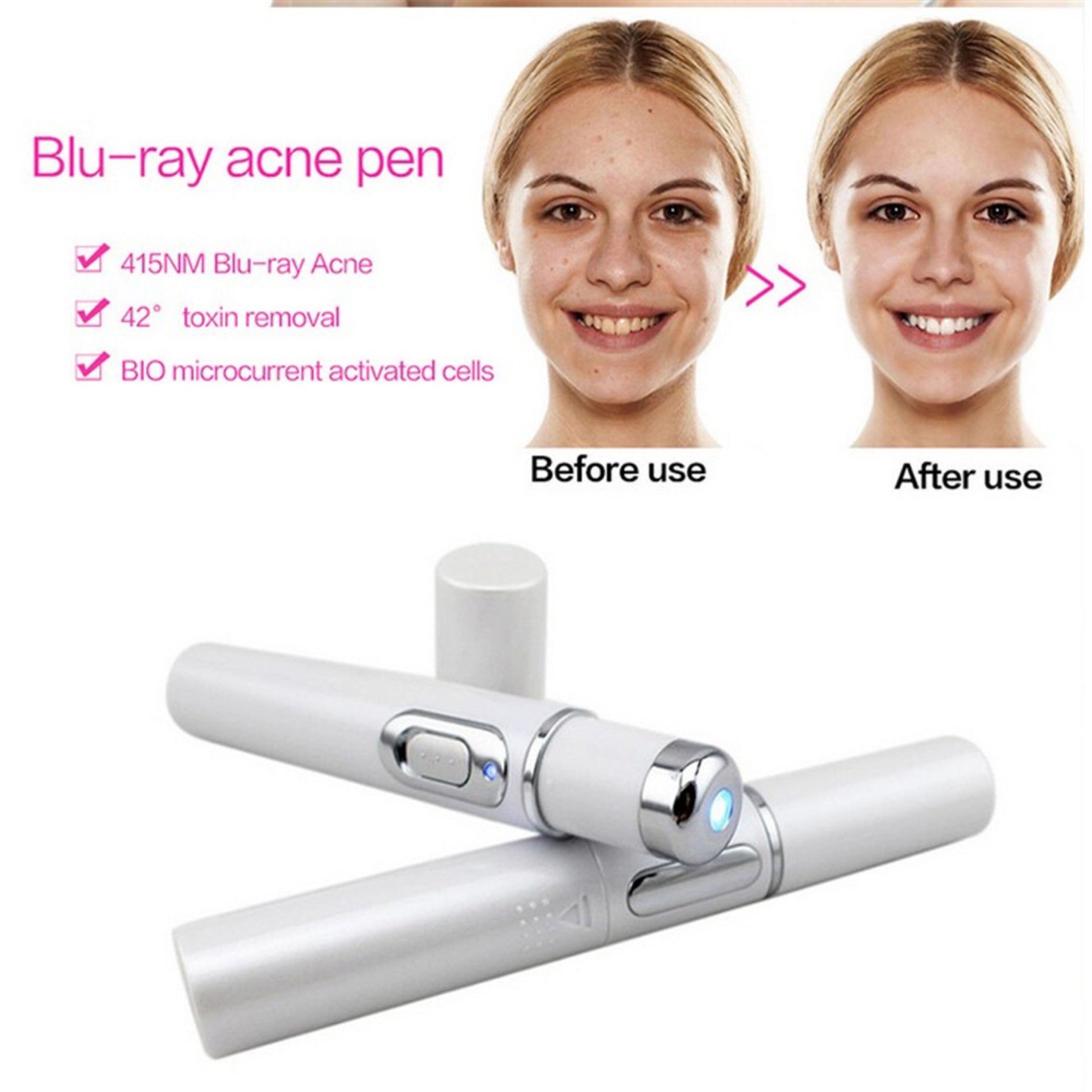 Blue Light Therapy Acne Laser Pen: Portable Scar & Wrinkle Removal Treatment Device for Flawless Skin Care Beauty Equipment
