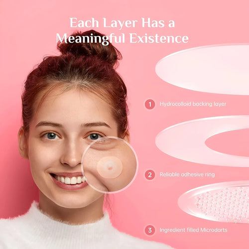 Clear acne patches in box for pimple and closed acne treatment