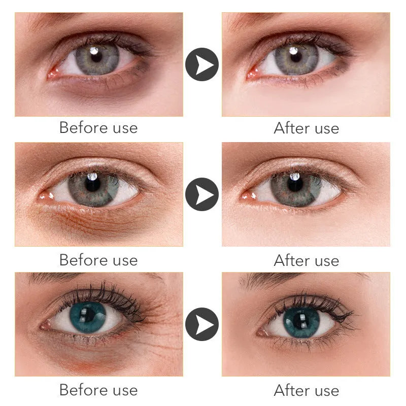 Beauty Eye Cream in a 30ml bottle for women's skincare.