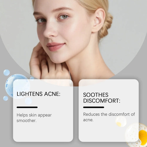 80-count pack of gentle hydrocolloid facial acne patches for spot treatment