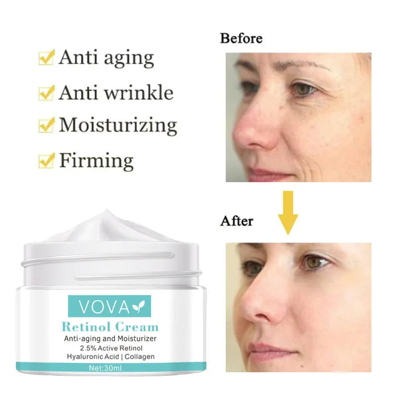 30ml collagen hyaluronic acid anti-wrinkle cream for moisturising, puffiness and skin tightening