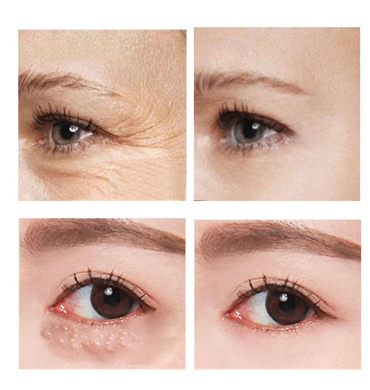 Beauty Eye Cream in a 30ml bottle for women's skincare.
