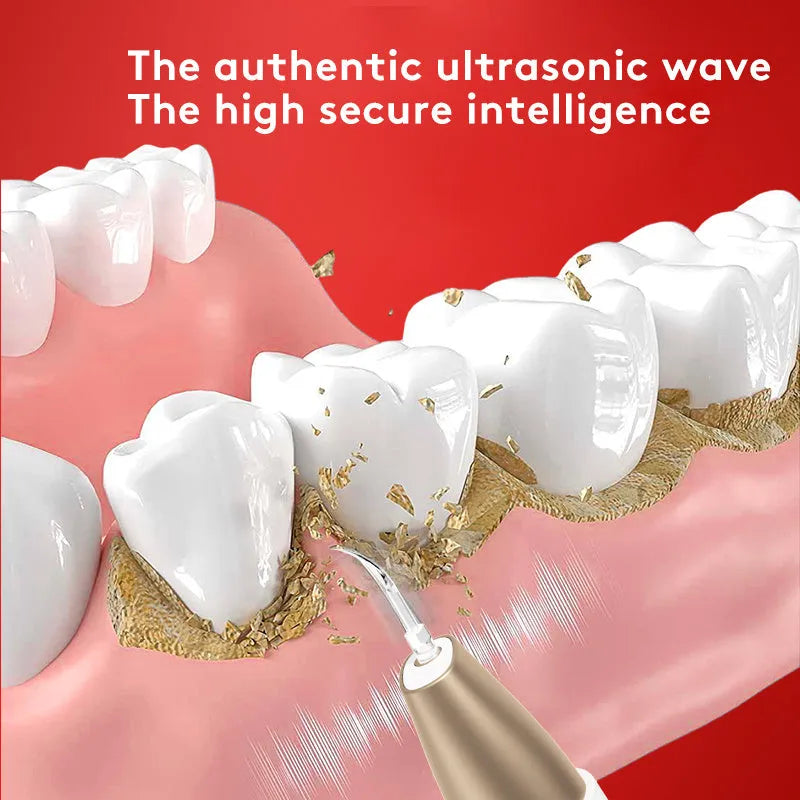 Gold ultrasonic tooth cleaner for removing tartar and stains with high-frequency vibration technology